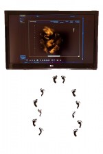 3D/4D Ultraschall